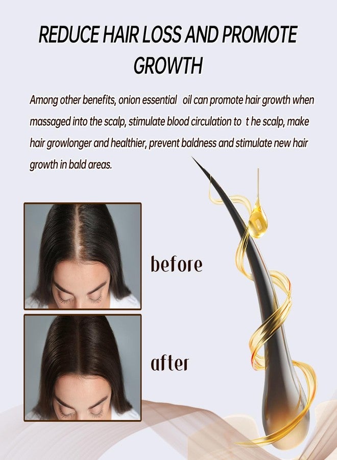 YILEST Onion & Rosemary Hair Growth Serum with Biotin & Arginine - Hydrating Scalp Treatment for Thicker Hair, 60ml - Image 5